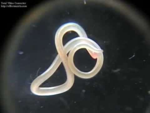 Ascaris lumbricoides