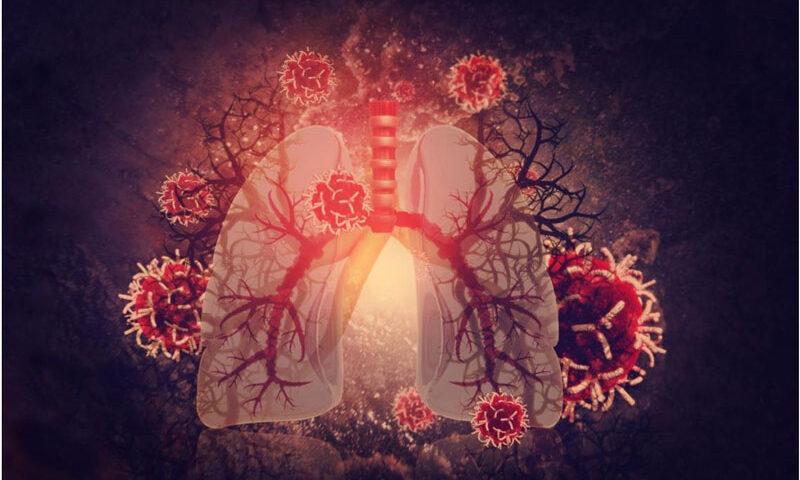 La grasa también se acumula en los pulmones