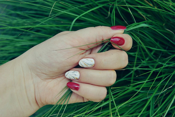 Anomalías y enfermedades de las uñas