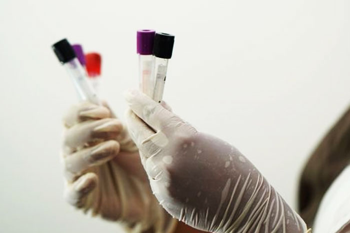 Vacuna Covid-19: recomendaciones para pacientes con hemofilia