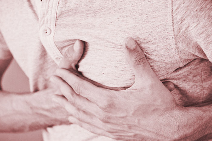 Se descubrió que 1 de cada 10 infartos se produce en menores de 45 años