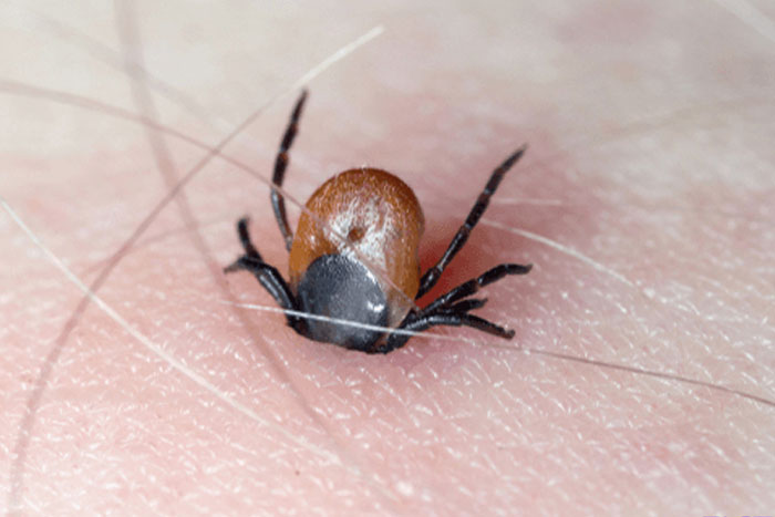 Fiebre maculosa de las Montañas Rocosas