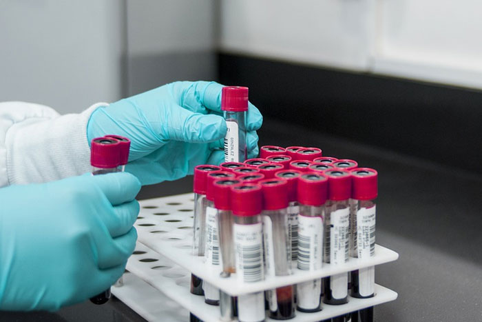 Claves para detectar la leucemia linfocítica crónica