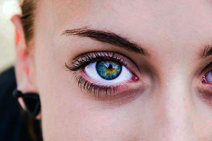 Qué causas ocasionan las caídas del párpado superior y cómo tratarlas