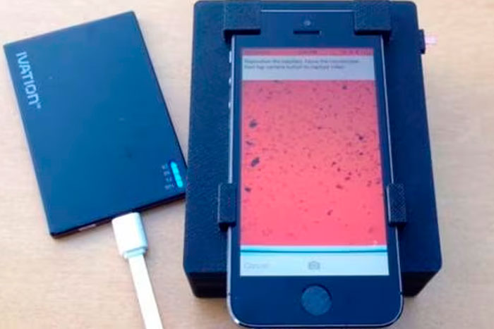 Un microscopio de teléfono celular para detectar parásitos